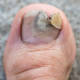 stinkyfoot3 User Avatar