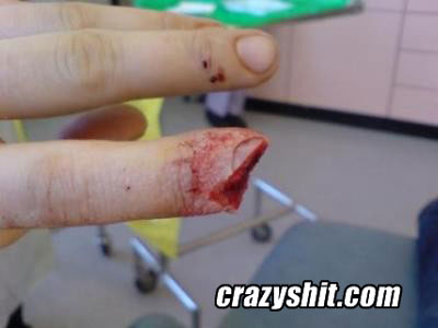 Chop Chop goes the finger