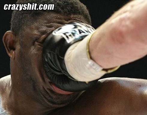 The wrong end of the boxing glove