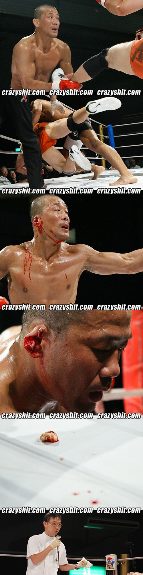 MMA fighter shigeyuki uchiyama Lost a bit o ear