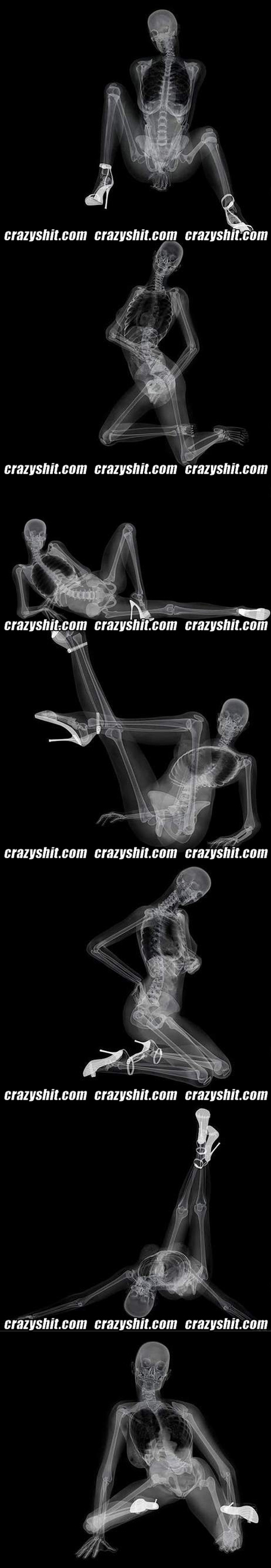 X-Ray Stripper