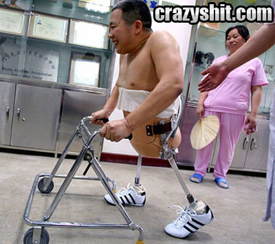 Asian Amputee Got His New Wheels