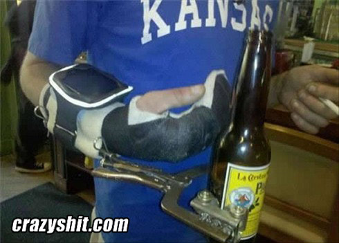 Broke Your Hand? Have A Beer!