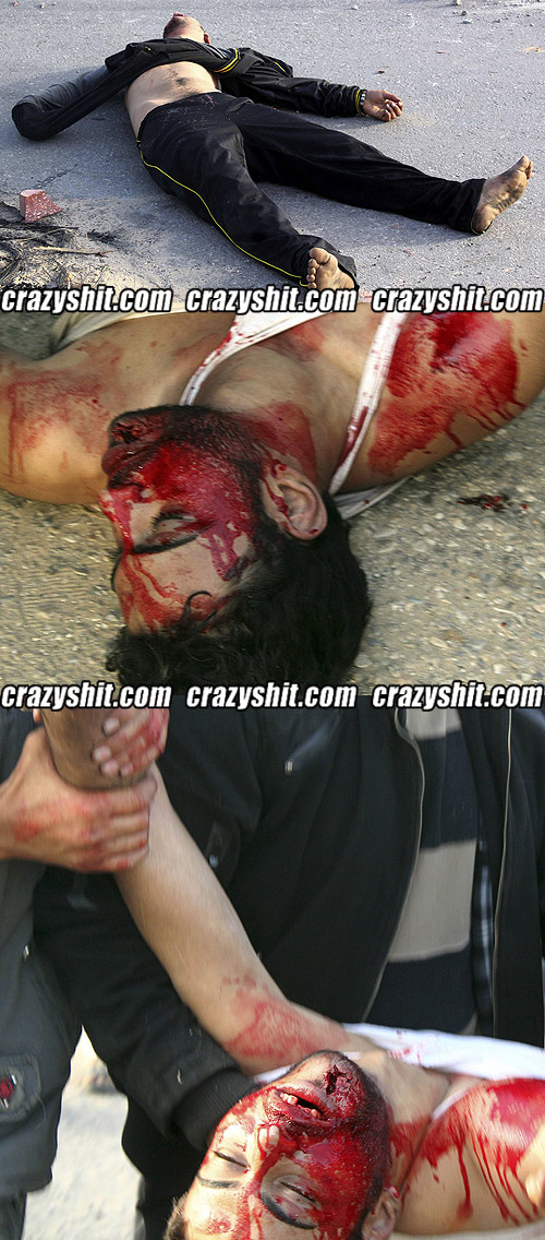 Egyptian Protester Team Injuries