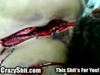 CrazyShit.com | Wrong End Of A Machete - Crazy Shit