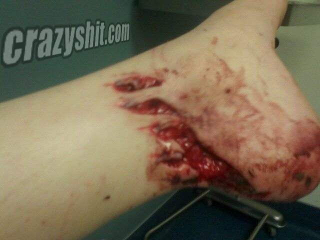 Chainsaw Vs. Foot