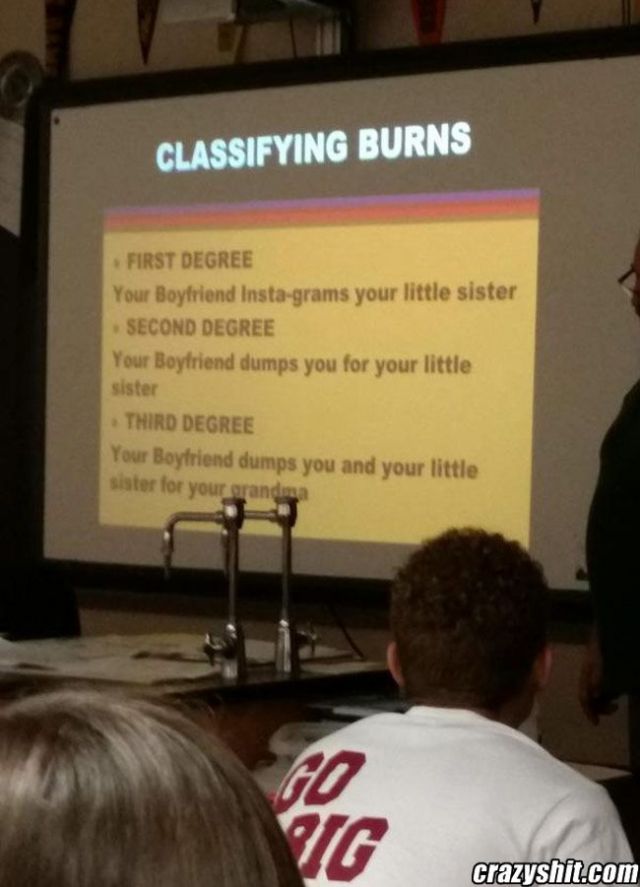 What Degree Did You Get Burned?