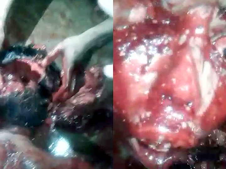 CrazyShit.com | WTF! SAVAGES LITERALLY RIP BRAINS OUT OF HIS HEAD - Crazy Shit