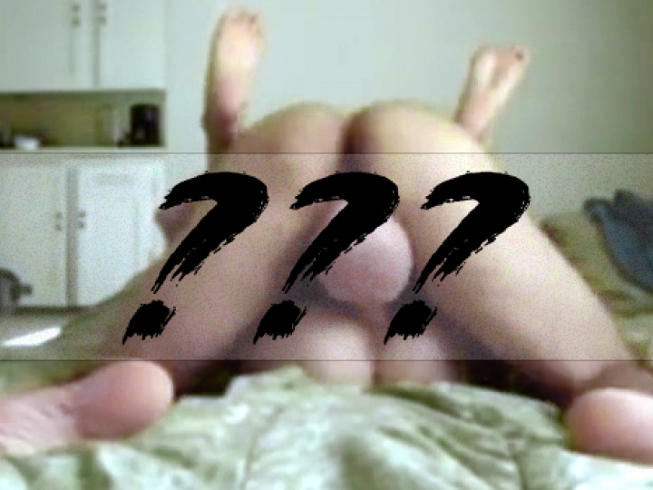 CrazyShit.com | WTF: IF YOUR BALLS LOOK LIKE THIS, SEEK HELP IMMEDIATELY - Crazy Shit