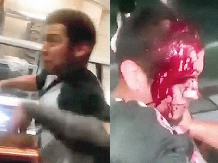 CrazyShit.com | WHEN HEADBUTTING IN A FIGHT GOES HORRIBLY WRONG - Crazy Shit 