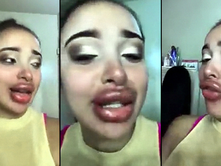CrazyShit.com | EPIC COSMETIC SURGERY FAIL - Crazy Shit