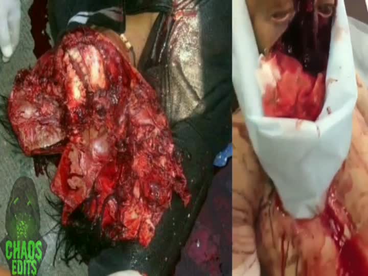 CrazyShit.com | SLAUGHTER TO PREVAIL - Crazy Shit