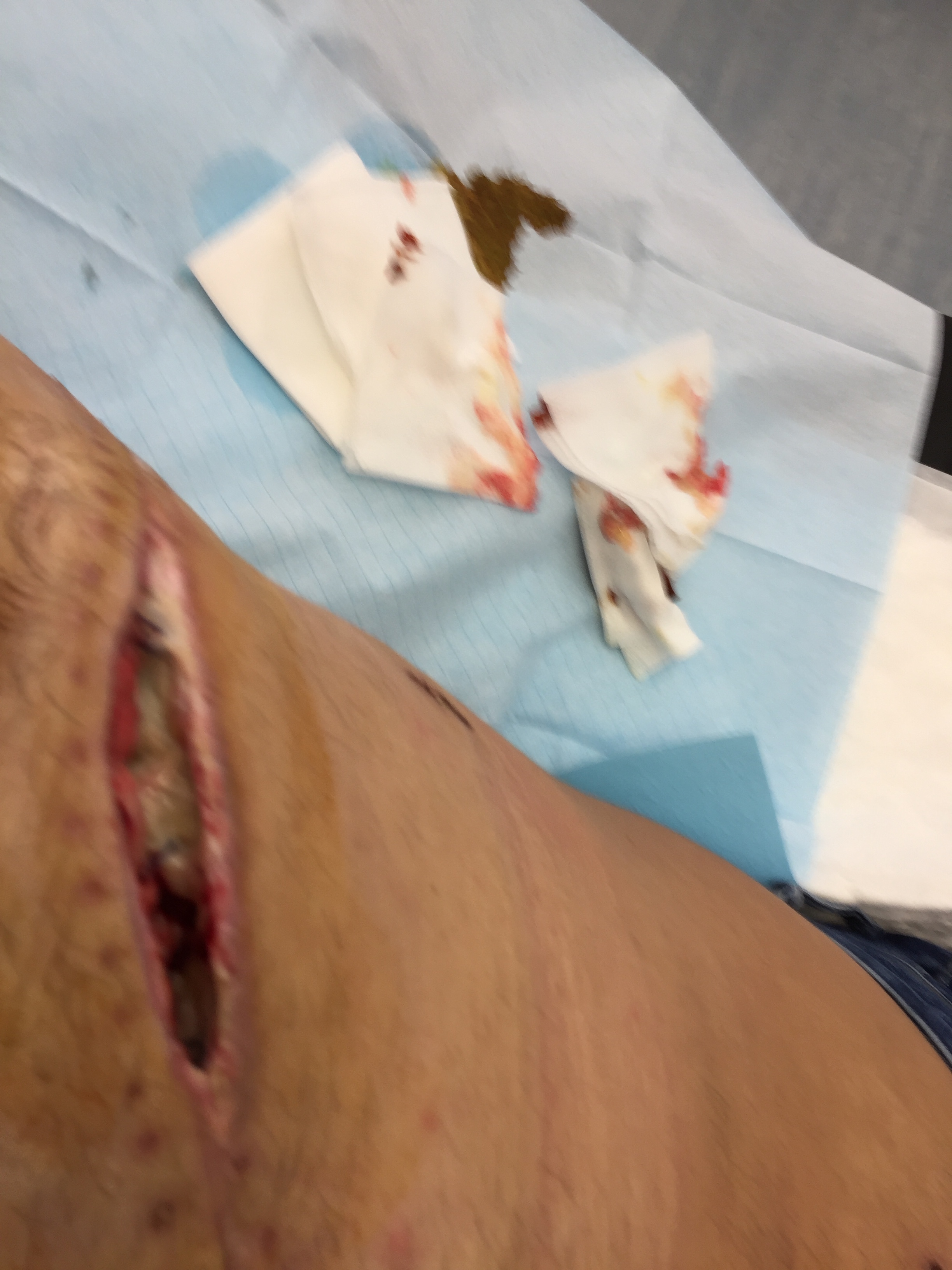 Open scar
