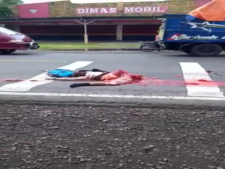 Graphic aftermath of motorcycle accident