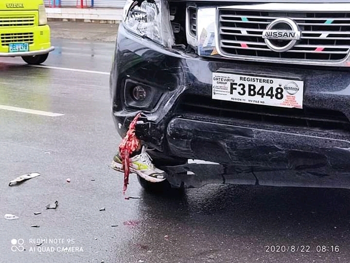 Foot stuck in the car