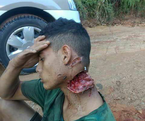 teen got hit in the neck with a machete