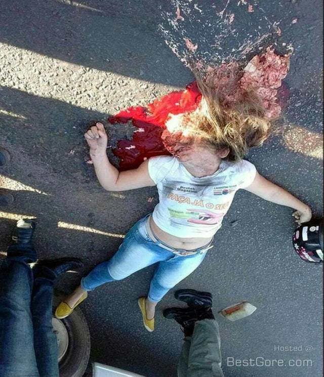 Girl's head got runned over by a car