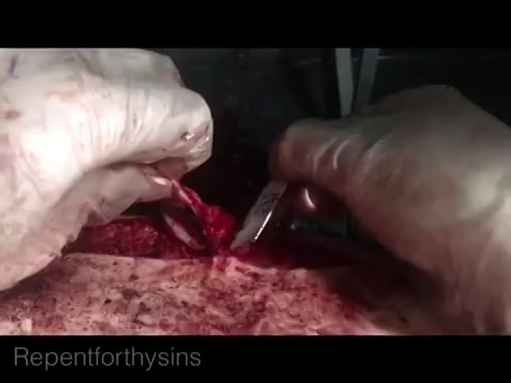 CrazyShit.com | Skinning - Crazy Shit