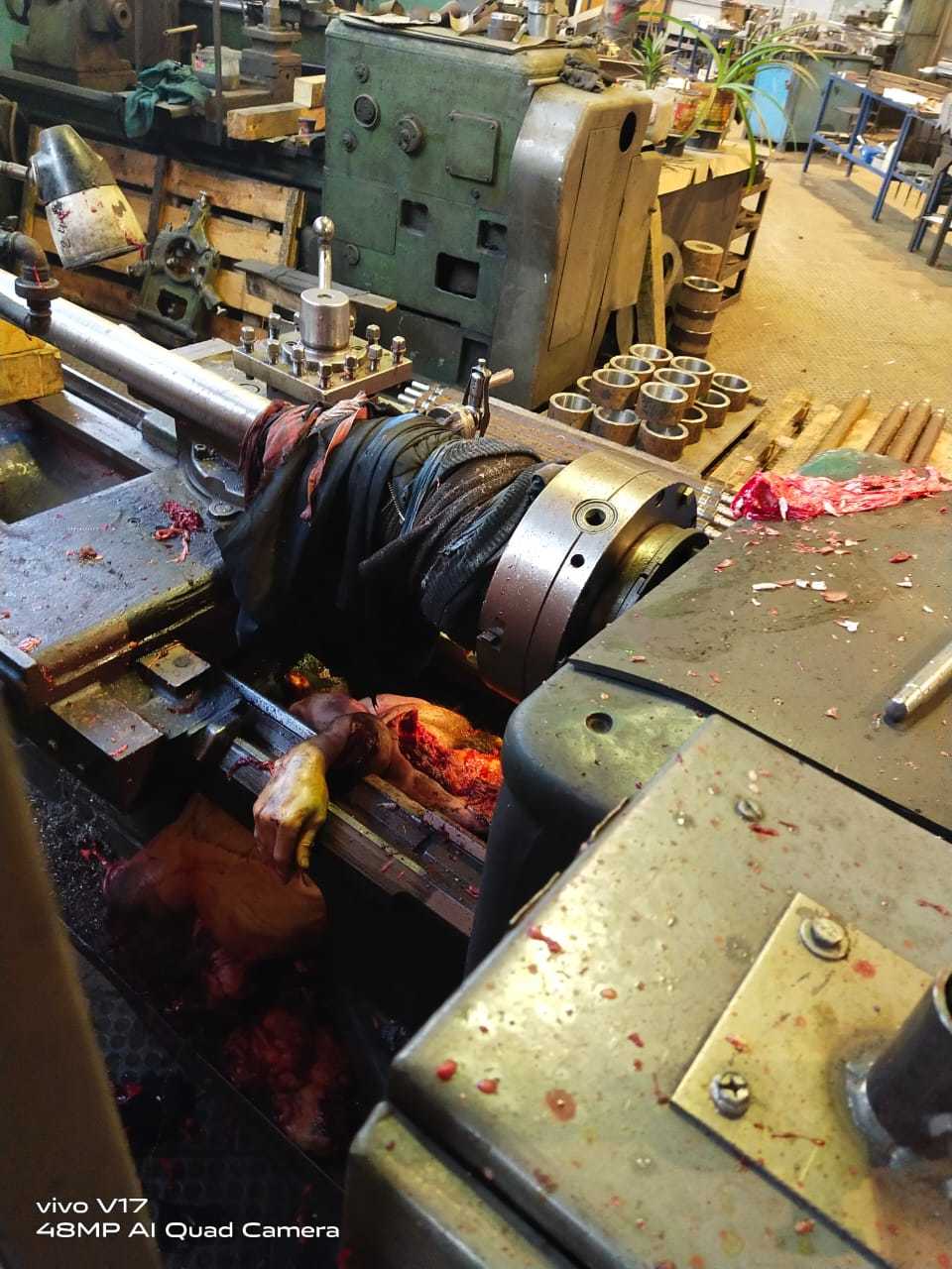 THE AFTERMATH OF THAT INSANE LATHE ACCIDENT IN RUSSIA