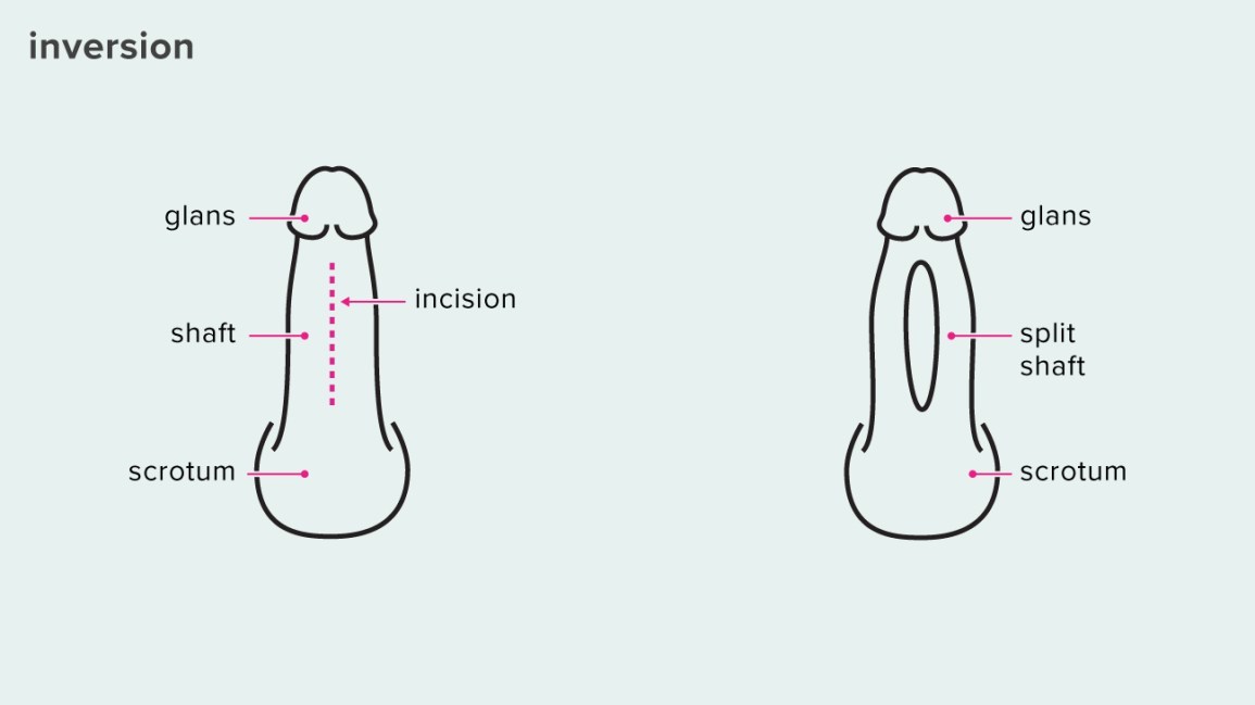 Penis Splitting- The Inversion