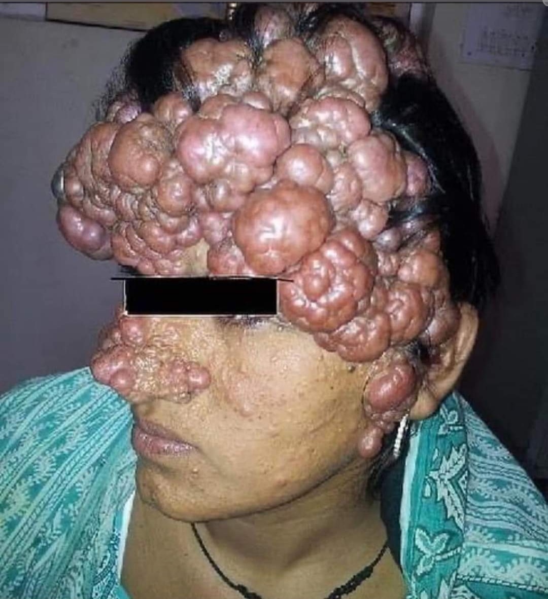 Bubble Head