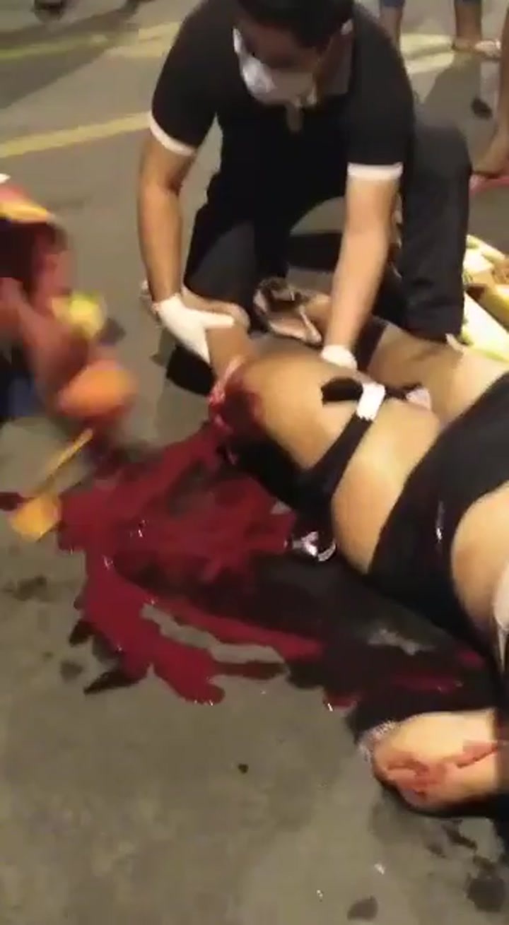 CrazyShit.com | woman had her leg cut off in a serious accident