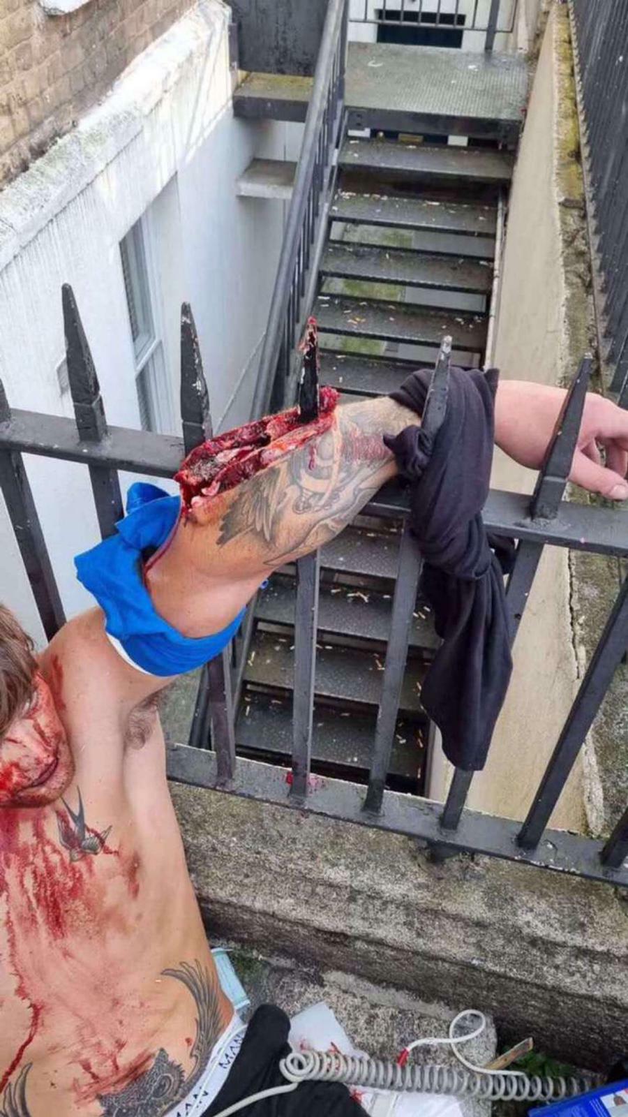 Dublin drug accident