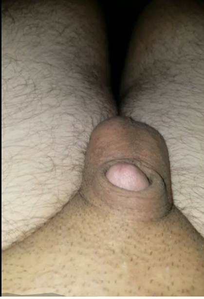 My Erect Penis