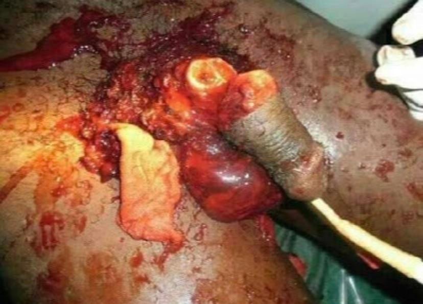 Severed…..