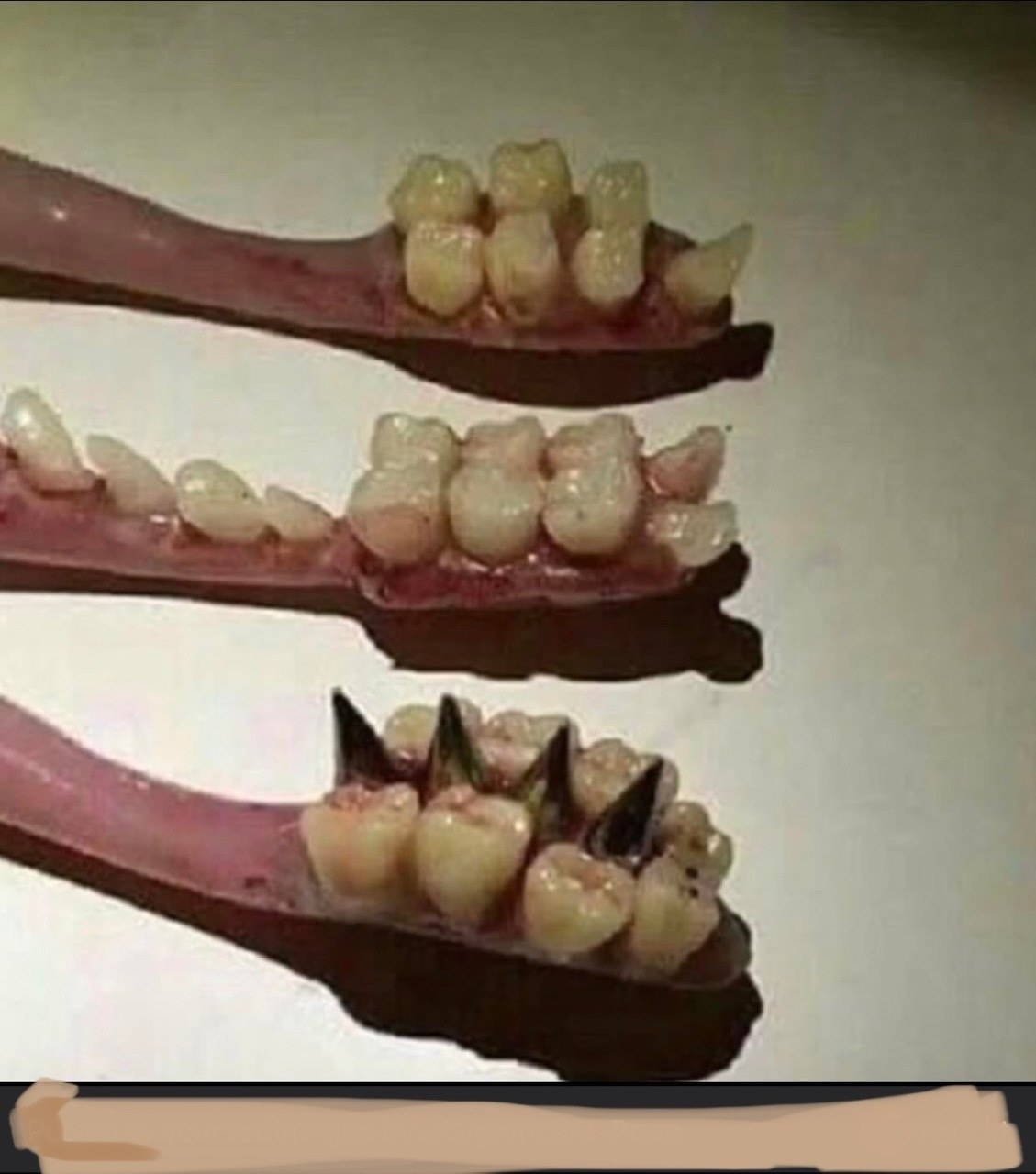 Tooth…..