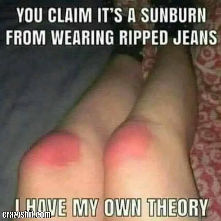 its just a sunburn