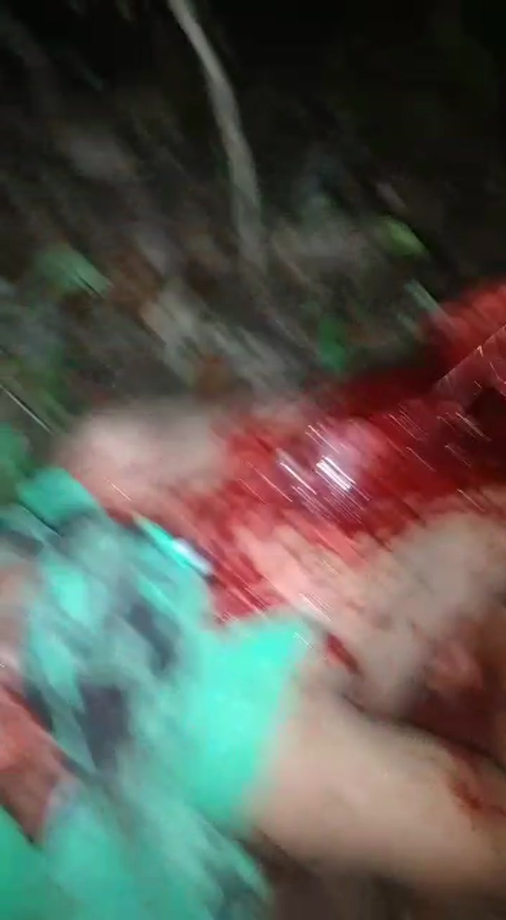 CrazyShit.com | Guts - Crazy Shit