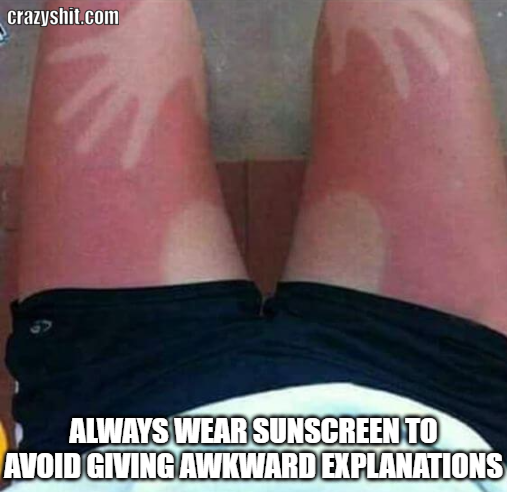 beware of sunburns