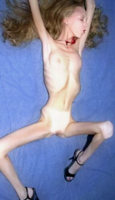 Bone