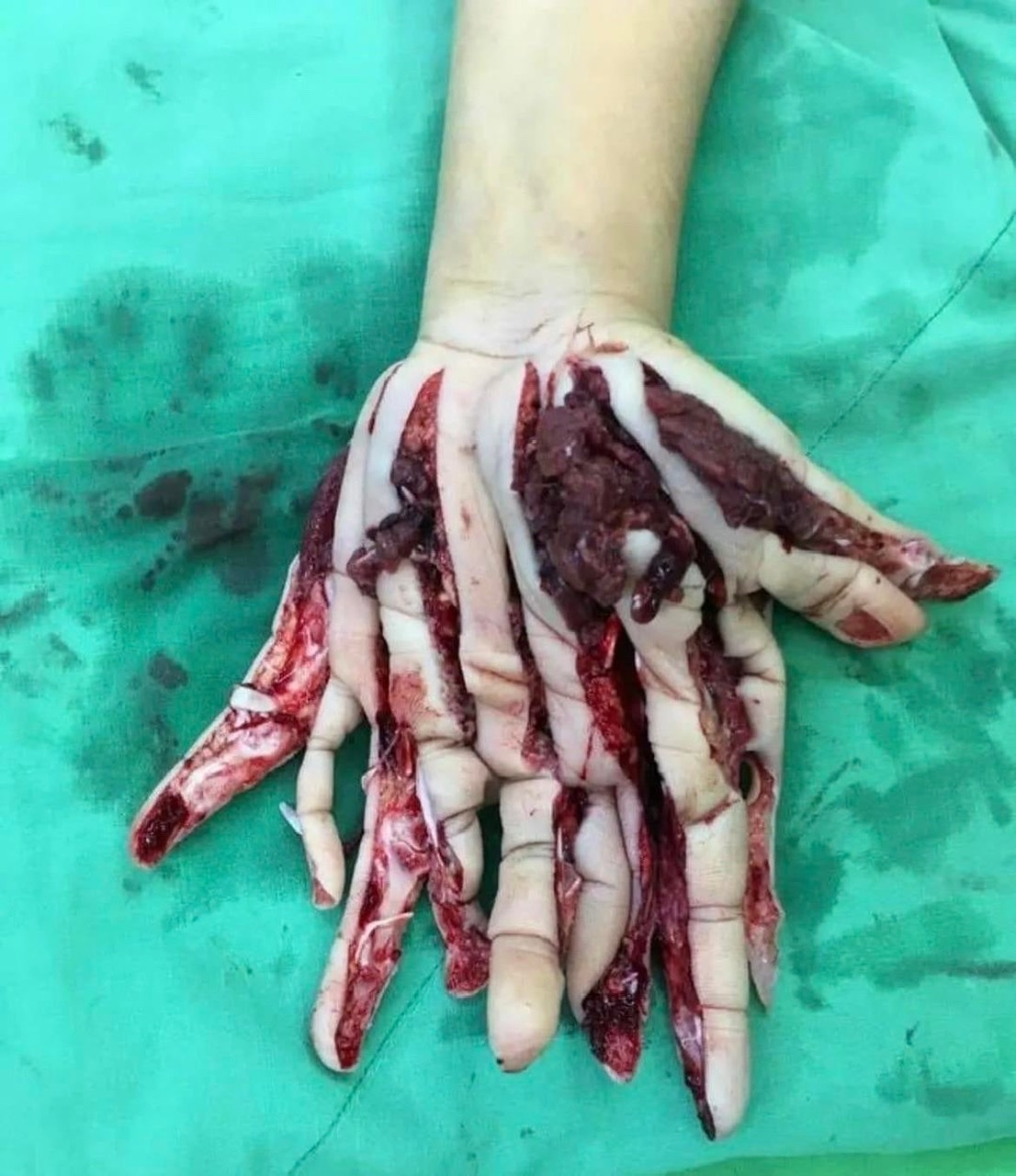 Hand…..