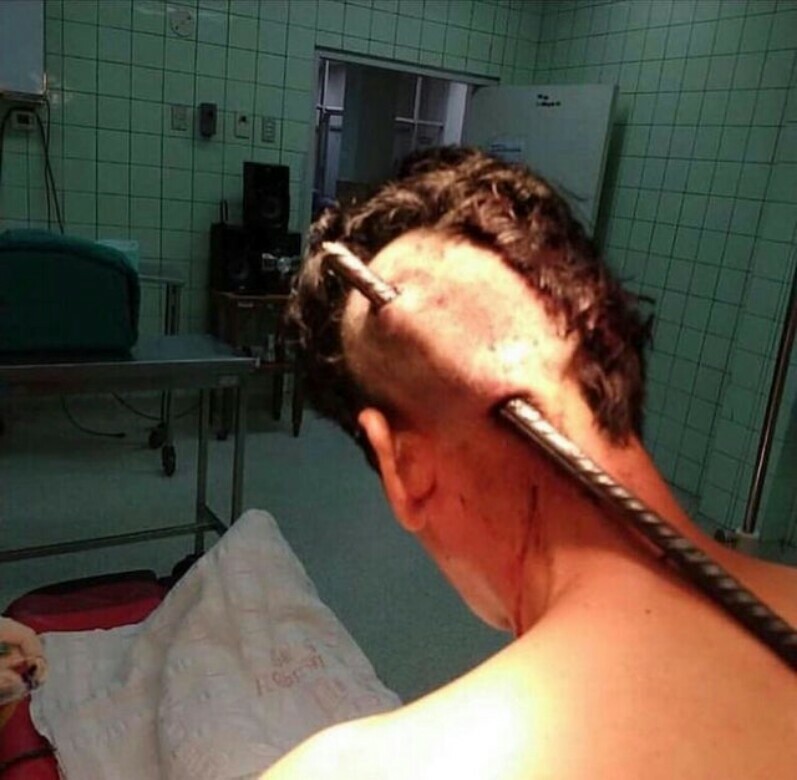 Through The Peeling