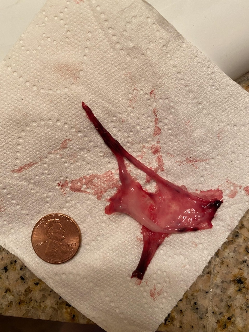 Shedding…..