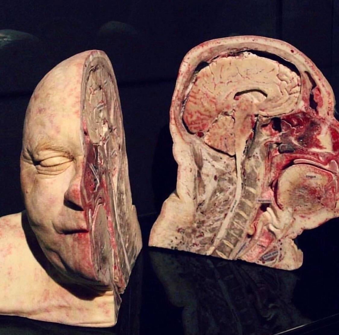 Head&hellip;..