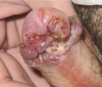 For you NASTY DIC PIC lovers