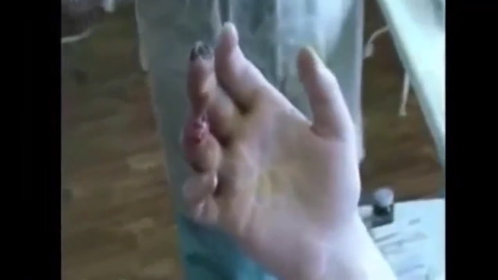 CrazyShit.com | Victim of krokodil drug - Crazy Shit