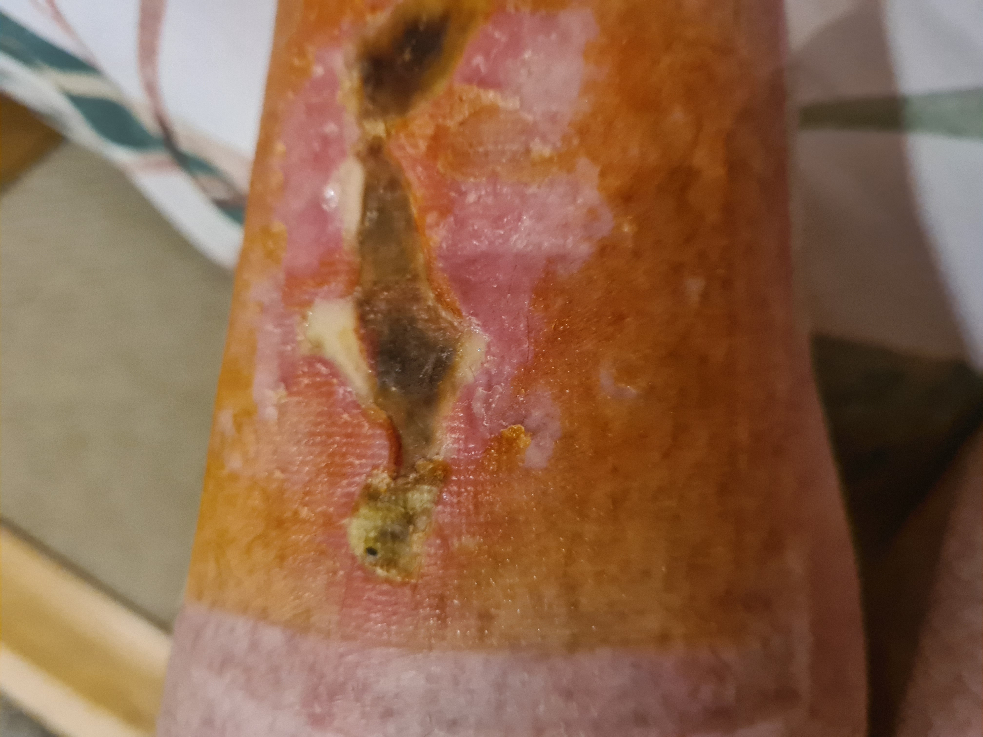 Leg
