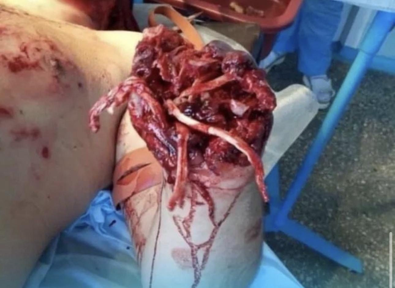A Bomb In The Hand…..