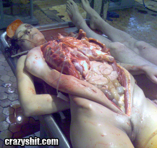 Eatable Insides!