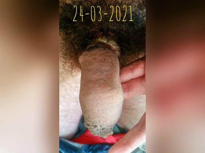 CrazyShit.com | I Cut Off My Penis With 1 X-acto for Religious Beliefs (Matthew 19:12) on 24 March 2021 in Oporto, Portugal - Crazy Shit 