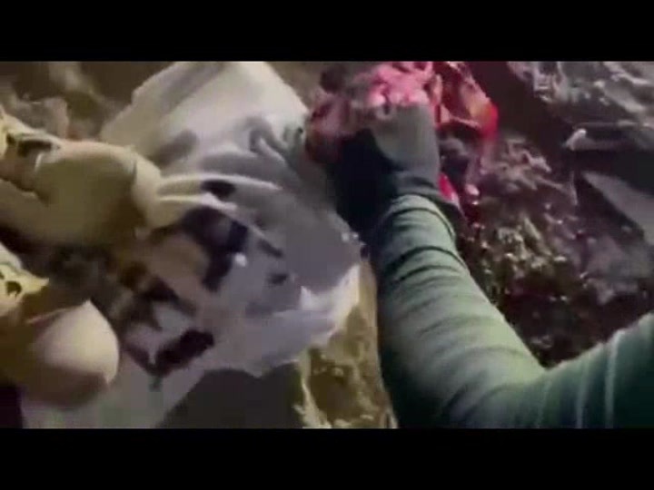 CrazyShit.com | Living Man Brutally Scalped, Face-Skinned ...