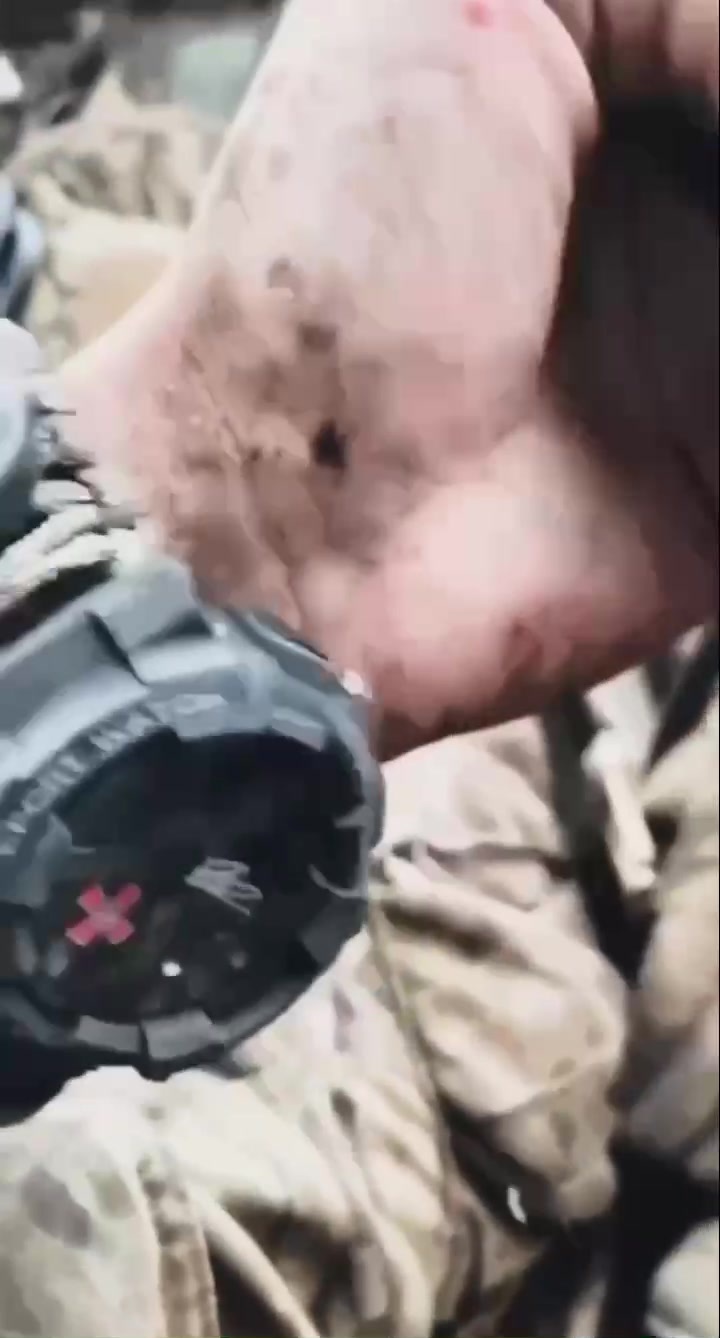 CrazyShit.com | Direct hit on Ukrainian trench - Crazy Shit