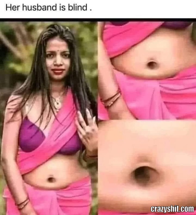 A Huge Belly Button
