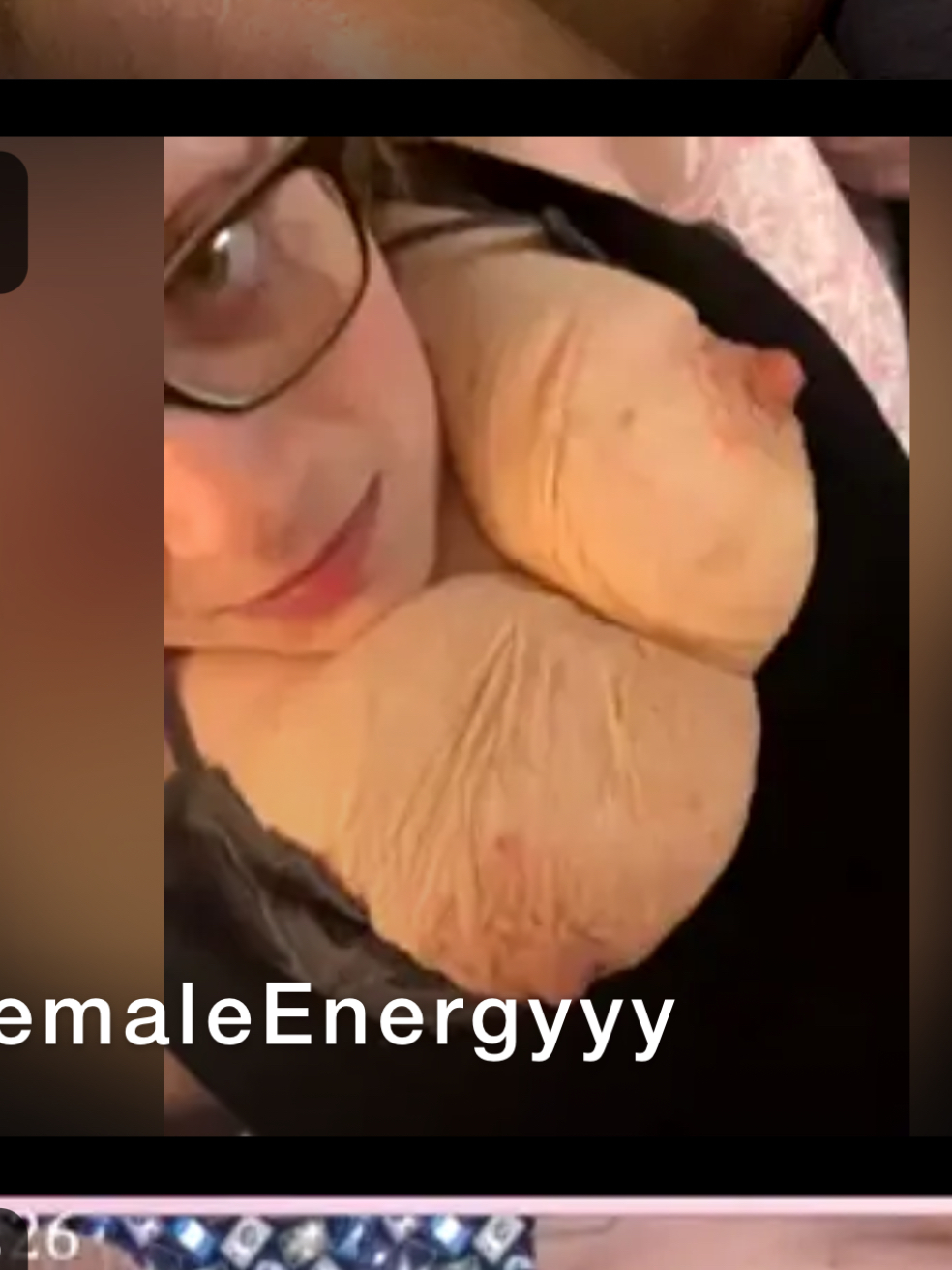 Really ugly tits! Yikes!