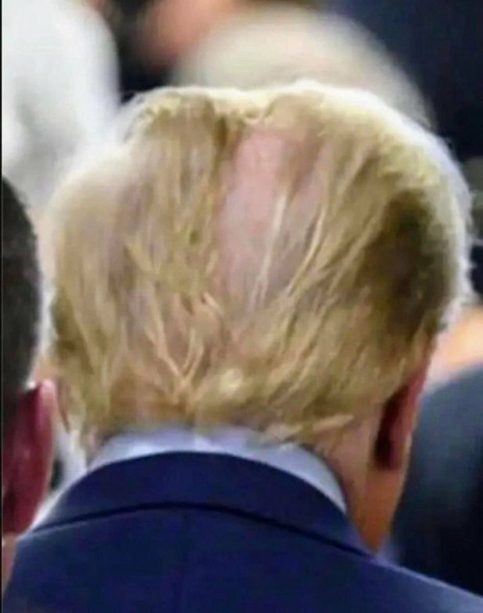 the back of trump's head....