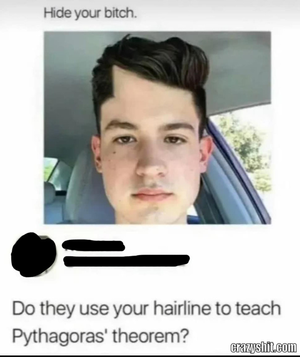 Nice Hairline